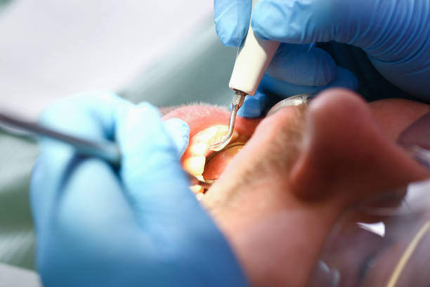 Best Mobile Emergency Dentist in De Pue, IL